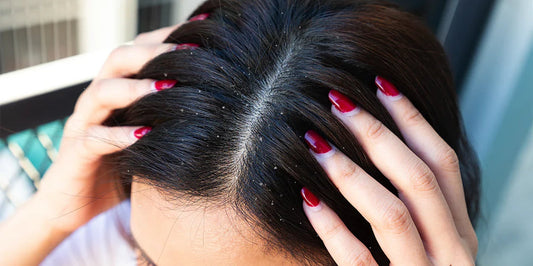 Dandruff: Proven Causes, Effective Treatments, and Expert Prevention Tips